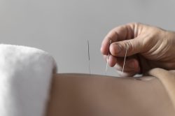 close-up-hand-holding-acupuncture-needle